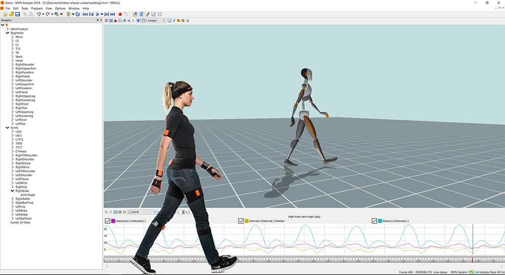 Human Movement Analysis Sense Hospital